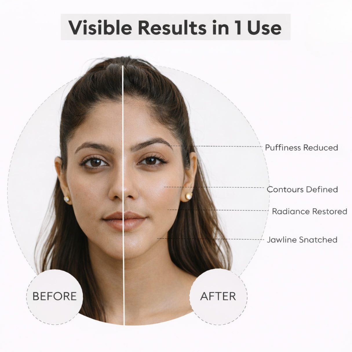 AHR Skin Lifting Device ( Collagen Support )