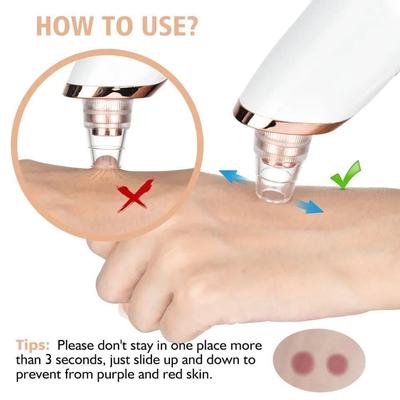 Blueidea Blackhead Remover Vacuum – Electric Facial Pore Cleaner