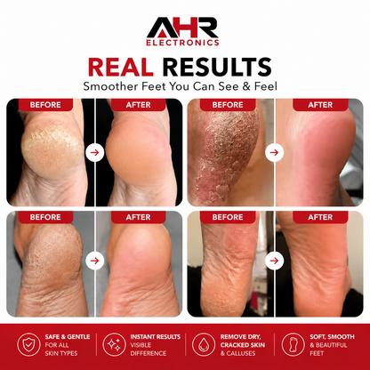 Premium Quality SmoothStep – Electric Foot File & Callus Remover